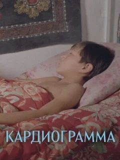  Кардиограмма 